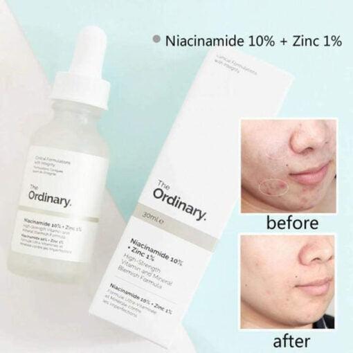 The Ordinary Niacinamide 10% + Zinc 1%: Blemish-Busting Serum for Clearer, Healthier Skin - Vibe Pk